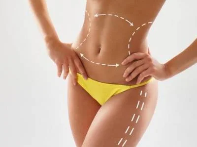Liposuction